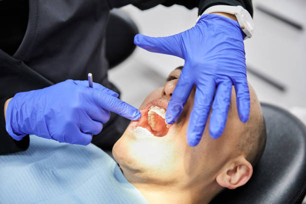 Best Tooth Infection Emergency Dentist  in Bay Harbor Islands, FL